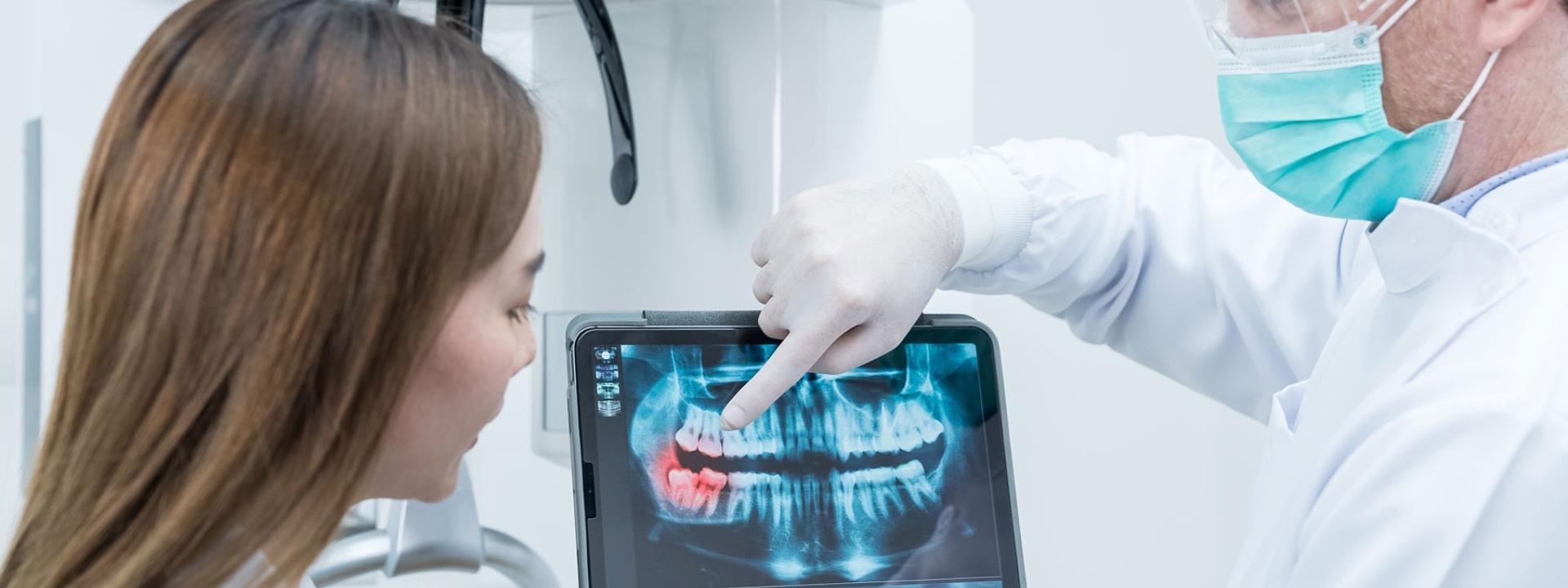 Digital x-rays dentistry